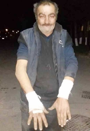 Bakıda canavar 54 yaşlı kişiyə hücum etdi - Foto